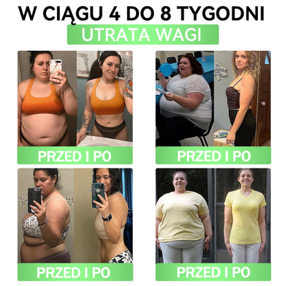 🎀ANGELTRAP® Moringa × Berberyna × AMPK 10-w-1 Wsparcie metaboliczne, plaster z nanotechnologią mikroigłową 🇵🇱(Wystarczy raz dziennie, widoczne efekty w 7 dni) ✅ Na otyłość, wiotką skórę, cukrzycę, bezdech senny, problemy ze stawami i wiele innych