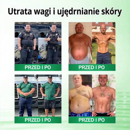 🎀ANGELTRAP® Moringa × Berberyna × AMPK 10-w-1 Wsparcie metaboliczne, plaster z nanotechnologią mikroigłową 🇵🇱(Wystarczy raz dziennie, widoczne efekty w 7 dni) ✅ Na otyłość, wiotką skórę, cukrzycę, bezdech senny, problemy ze stawami i wiele innych