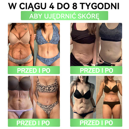 🎀ANGELTRAP® Moringa × Berberyna × AMPK 10-w-1 Wsparcie metaboliczne, plaster z nanotechnologią mikroigłową 🇵🇱(Wystarczy raz dziennie, widoczne efekty w 7 dni) ✅ Na otyłość, wiotką skórę, cukrzycę, bezdech senny, problemy ze stawami i wiele innych