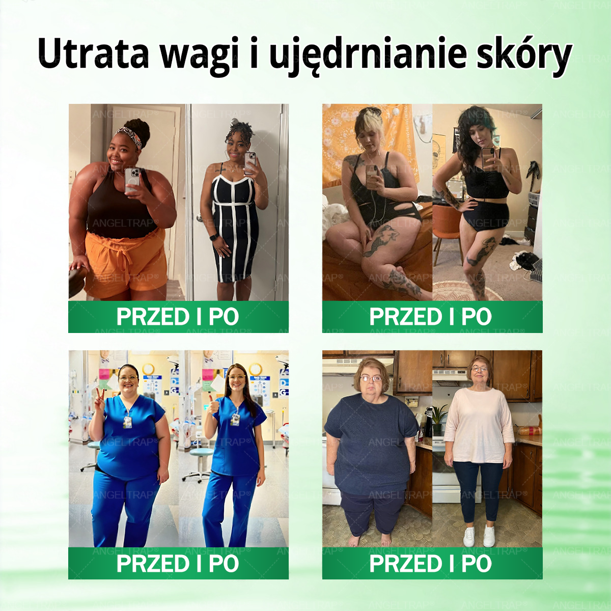 🎀ANGELTRAP® Moringa × Berberyna × AMPK 10-w-1 Wsparcie metaboliczne, plaster z nanotechnologią mikroigłową 🇵🇱(Wystarczy raz dziennie, widoczne efekty w 7 dni) ✅ Na otyłość, wiotką skórę, cukrzycę, bezdech senny, problemy ze stawami i wiele innych