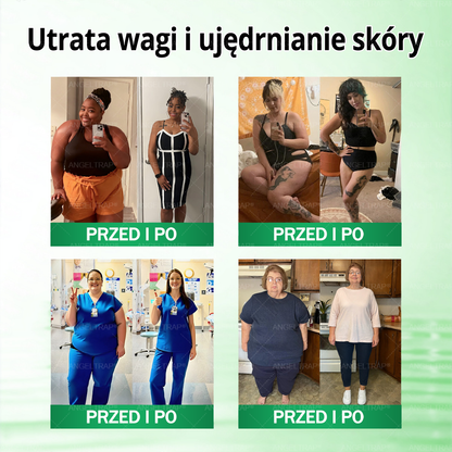 🎀ANGELTRAP® Moringa × Berberyna × AMPK 10-w-1 Wsparcie metaboliczne, plaster z nanotechnologią mikroigłową 🇵🇱(Wystarczy raz dziennie, widoczne efekty w 7 dni) ✅ Na otyłość, wiotką skórę, cukrzycę, bezdech senny, problemy ze stawami i wiele innych